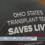 Ohio State Wexner Medical Center performs living kidney donor transplant chain